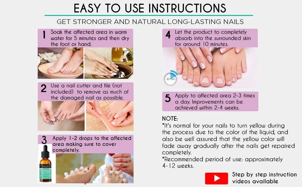 Karlash Finger & Toenail Fungus Remover Solution EXTRA STRONG