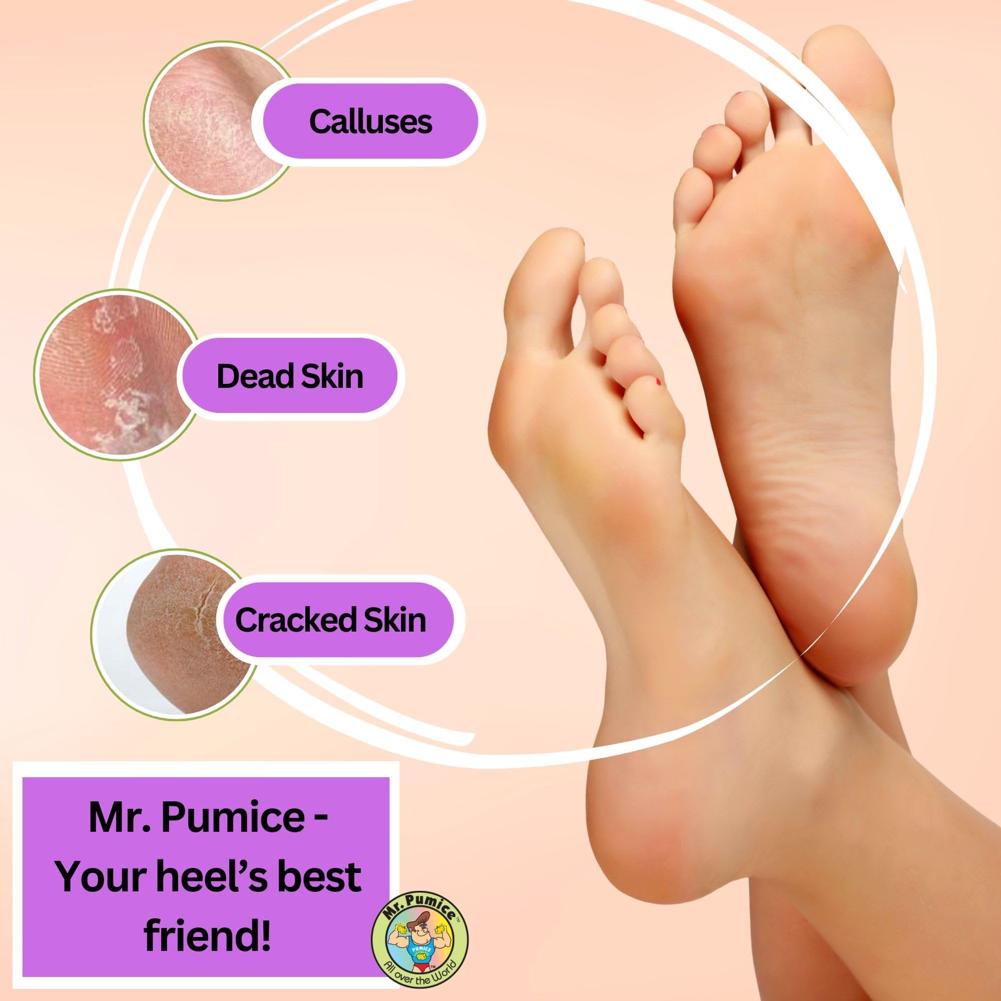 Mr. Pumice Ultimate Pumi Bar 2-in-1 Callus Remover Stone & Foot/Heel Scrubber - Medium & Coarse Grit