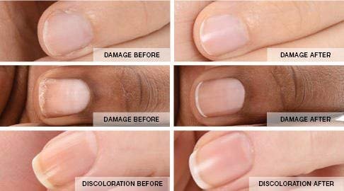 Maccibelle Nail Hardener-Nail Strengthener Repair Weak Damaged Nails